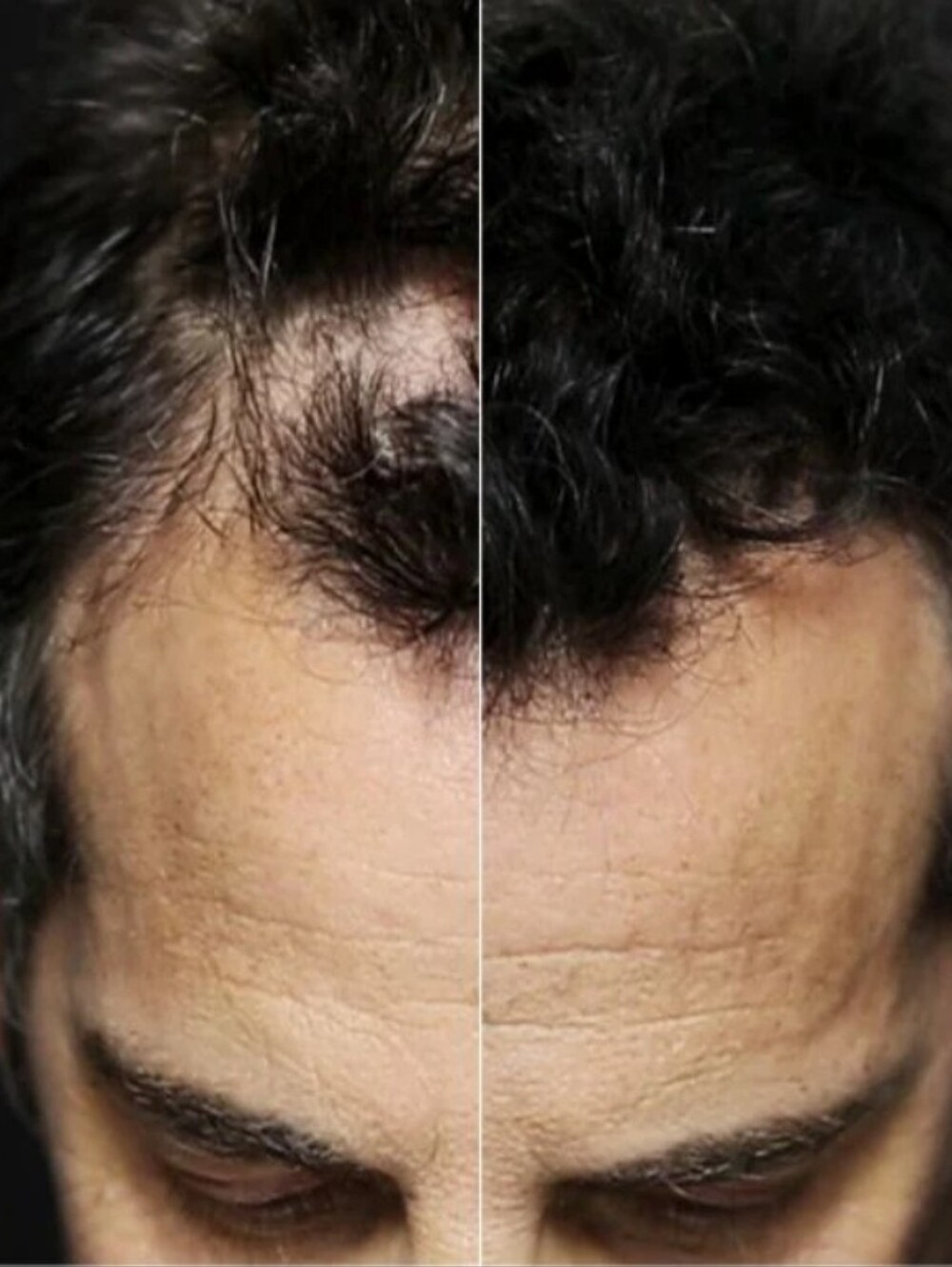 Toppik hair fiber (Dark Brown) - Picture 6 of 6